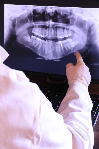 Best Chipped Tooth Repair Near Me  in Mapleton, UT